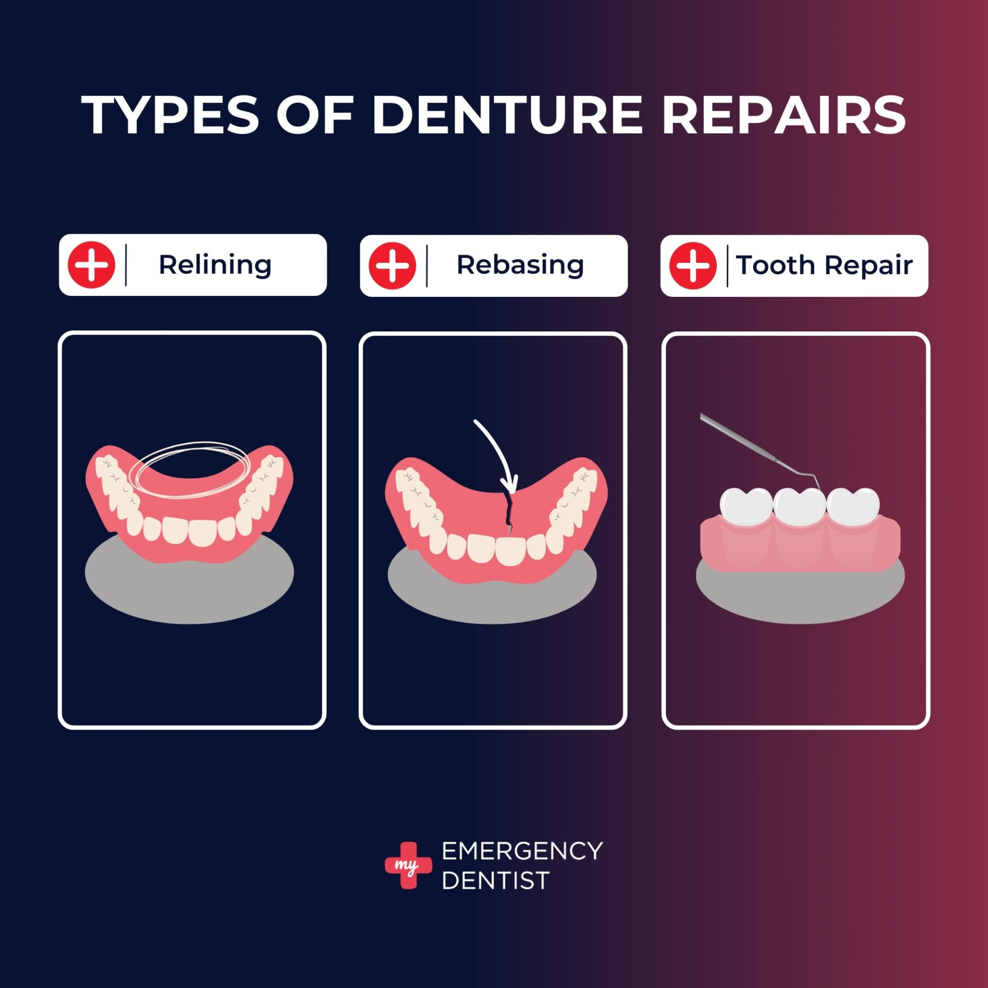 Emergency Denture Repairs in Perth